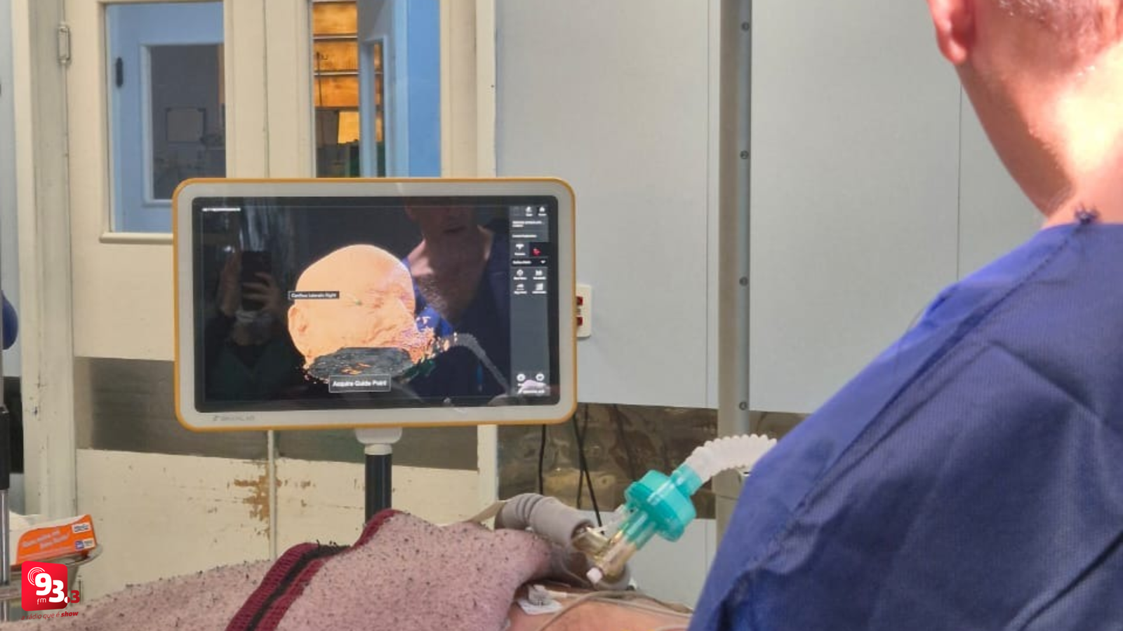 Leia mais sobre o artigo Complexo Hospitalar de Barbacena realiza primeira cirurgia com uso de neuronavegação
